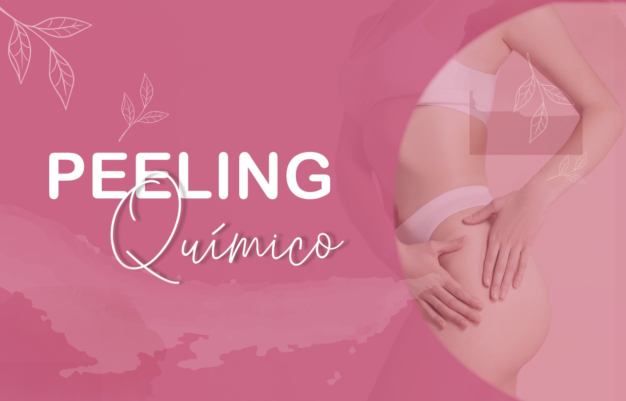 Peeling químico