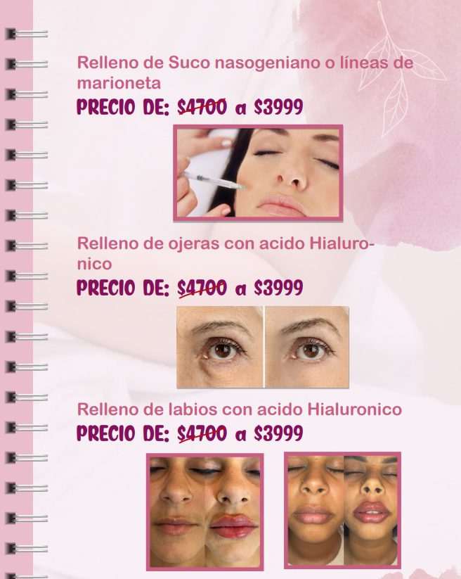 Promociones