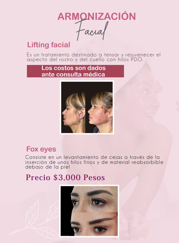 Promociones