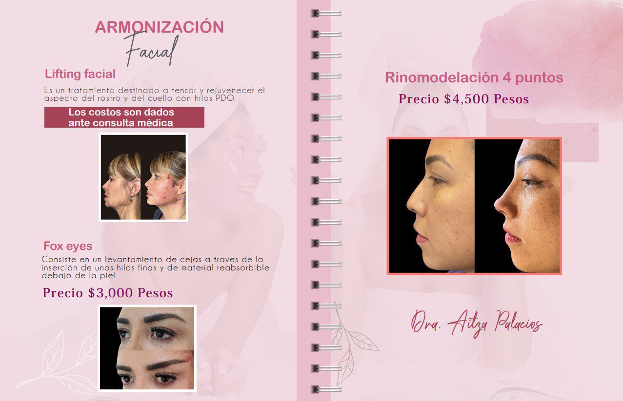 Promociones